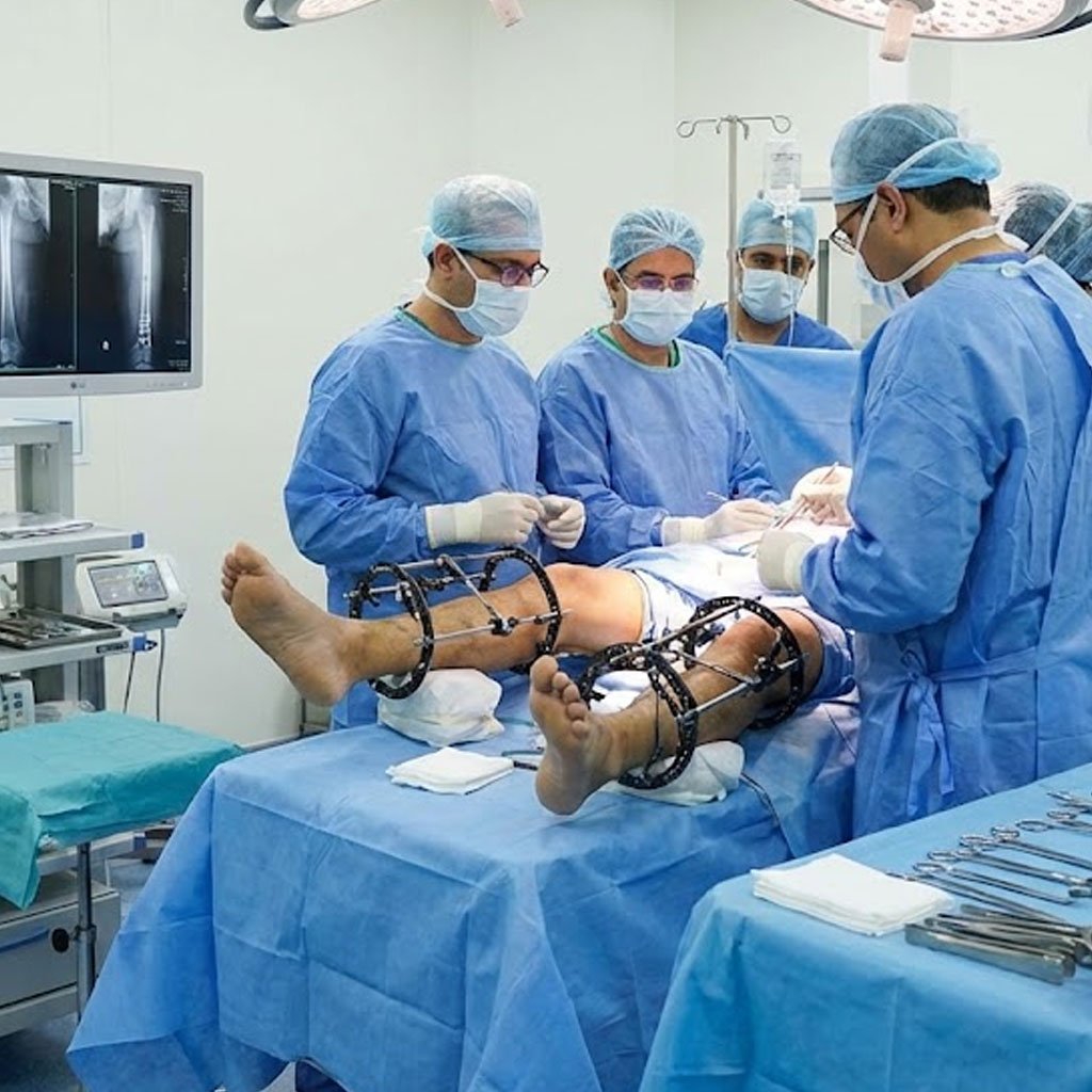 Bilateral Femoral Lengthening Surgery